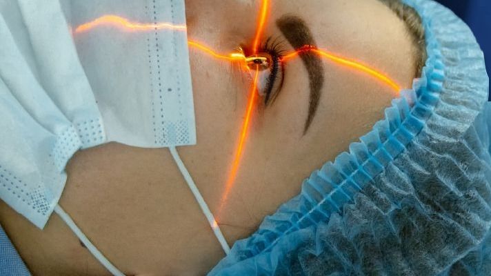Atención de cirugía refractiva (excimer láser) en la Clínica Estudios Oftalmológicos